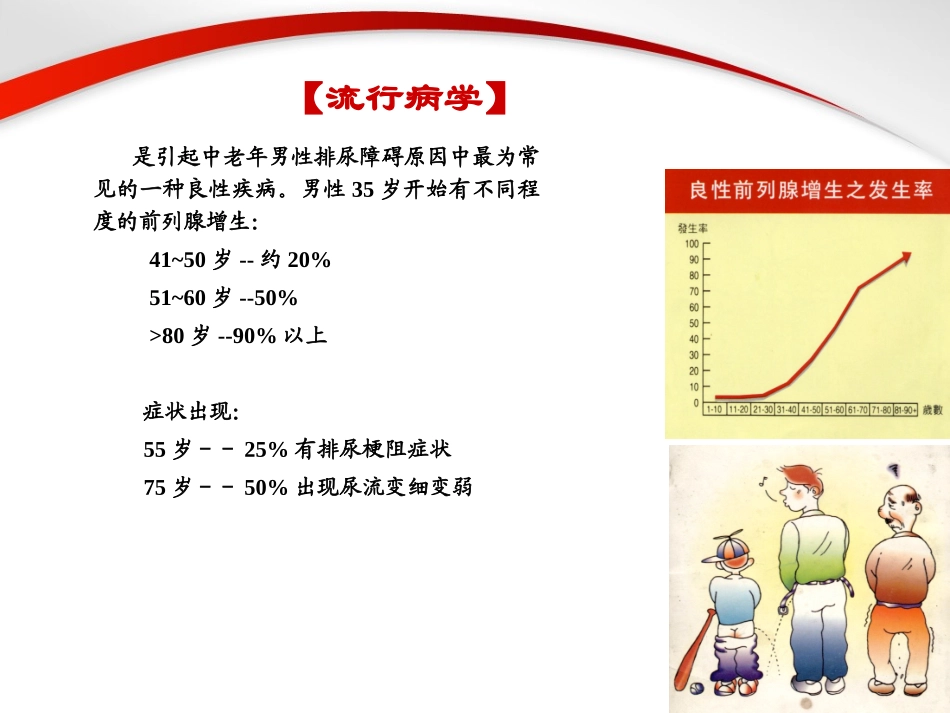 前列腺增生症.PPT_第2页