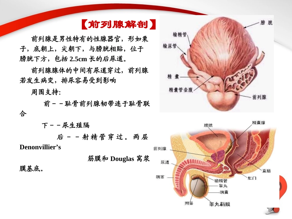 前列腺增生症.PPT_第3页