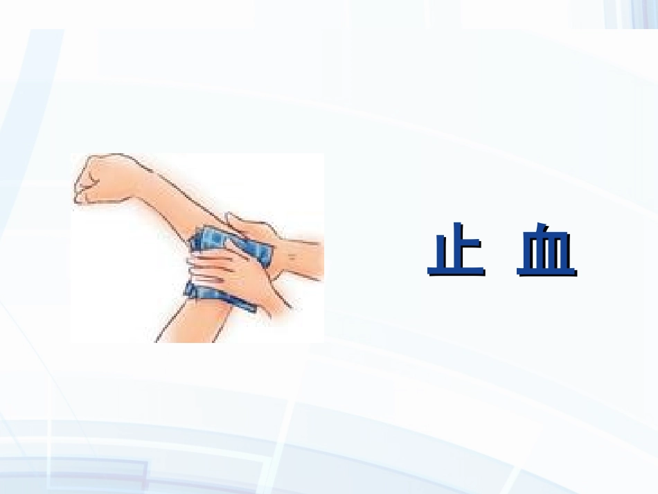 创伤止血包扎固定搬运PPT_第3页