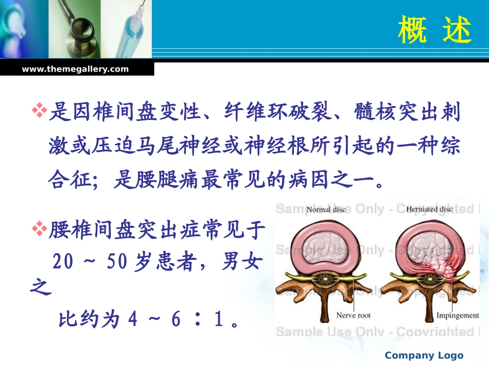 腰-椎-间-盘-突-出-症(欧)_第2页