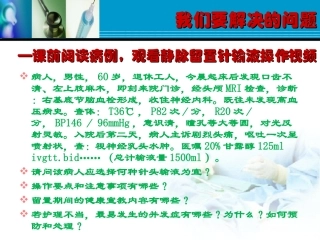 静脉留置针输液法