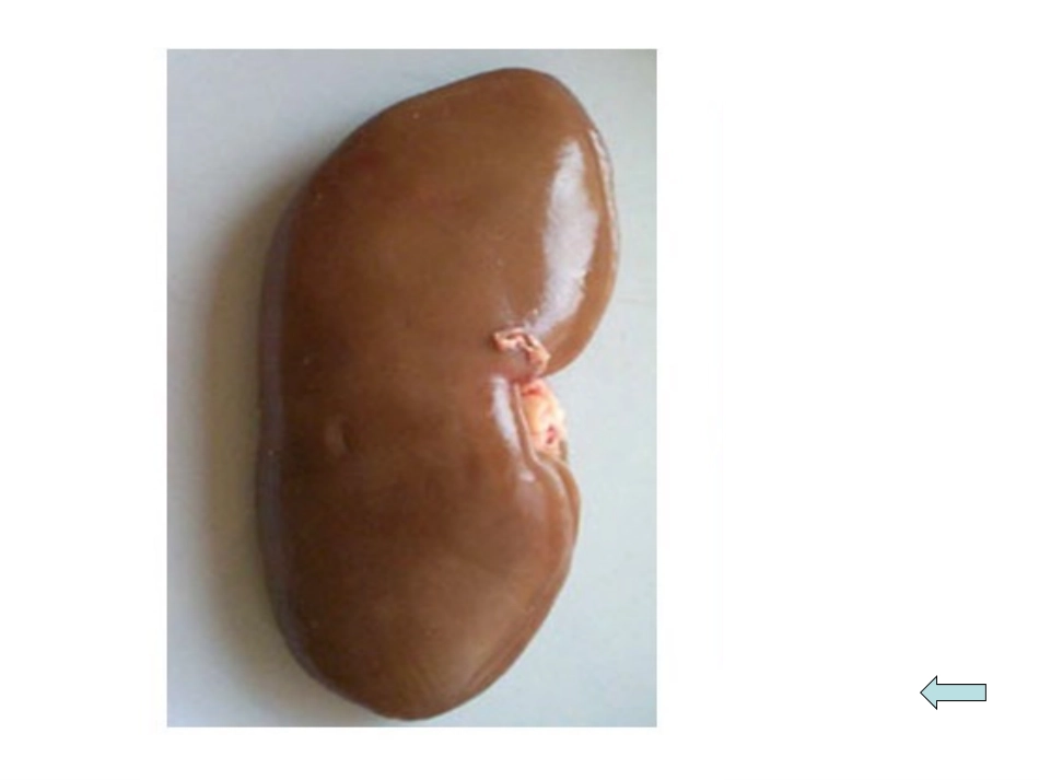 尿液的形成和排出1_第2页