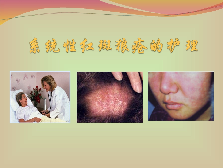 系统性红狼疮教学查房_第1页