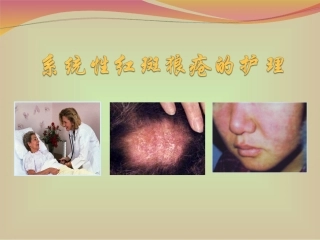 系统性红狼疮教学查房