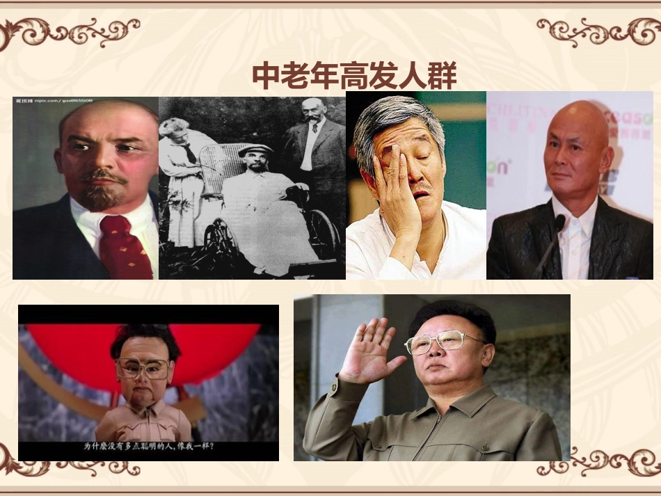 如何正确认识脑梗塞.._第2页