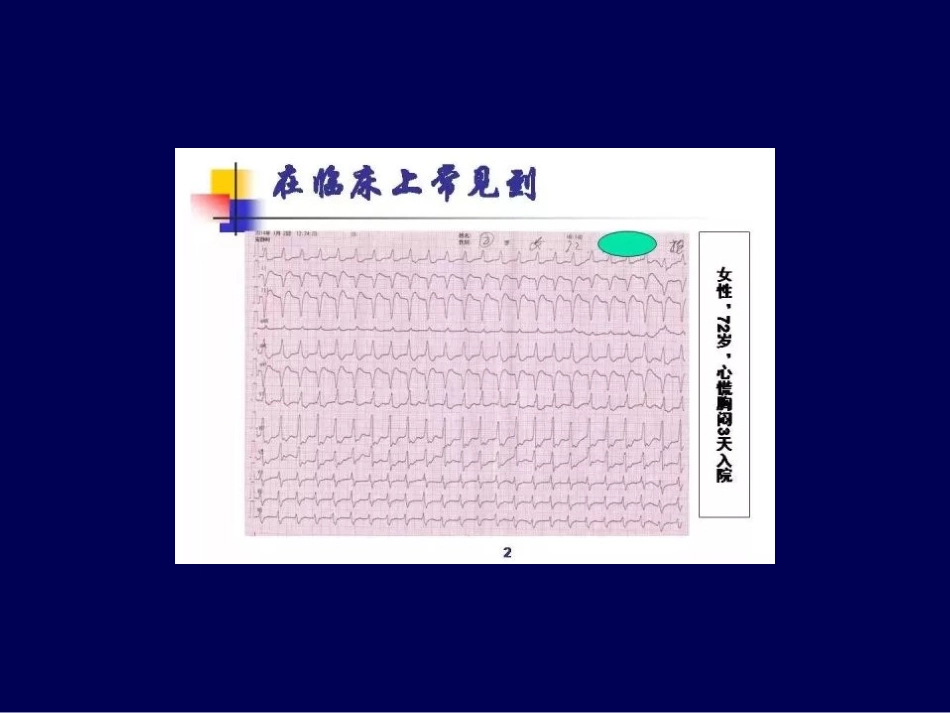 快速性心律失常急诊处理策略_第2页