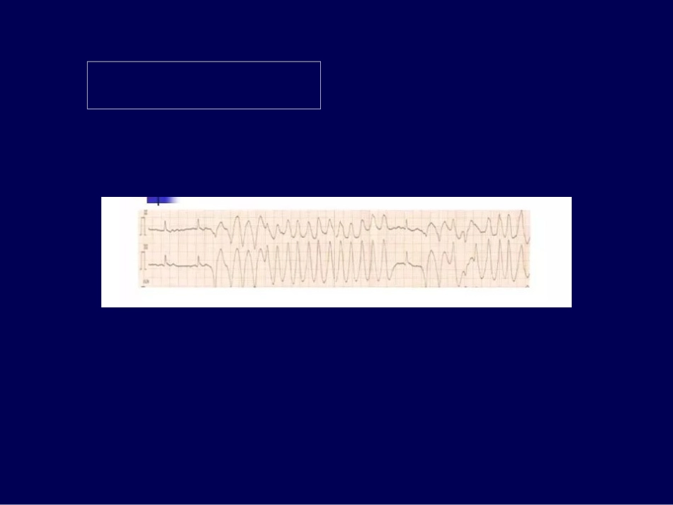 快速性心律失常急诊处理策略_第3页