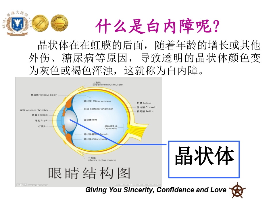 邵逸夫医院白内障术前宣教_第3页