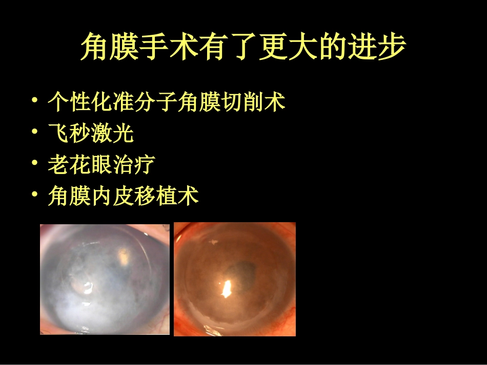 屈光手术时代 如何理解屈光系统成像质量--郝燕生_第3页