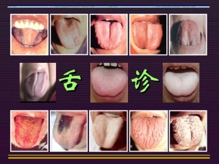 中诊--舌诊