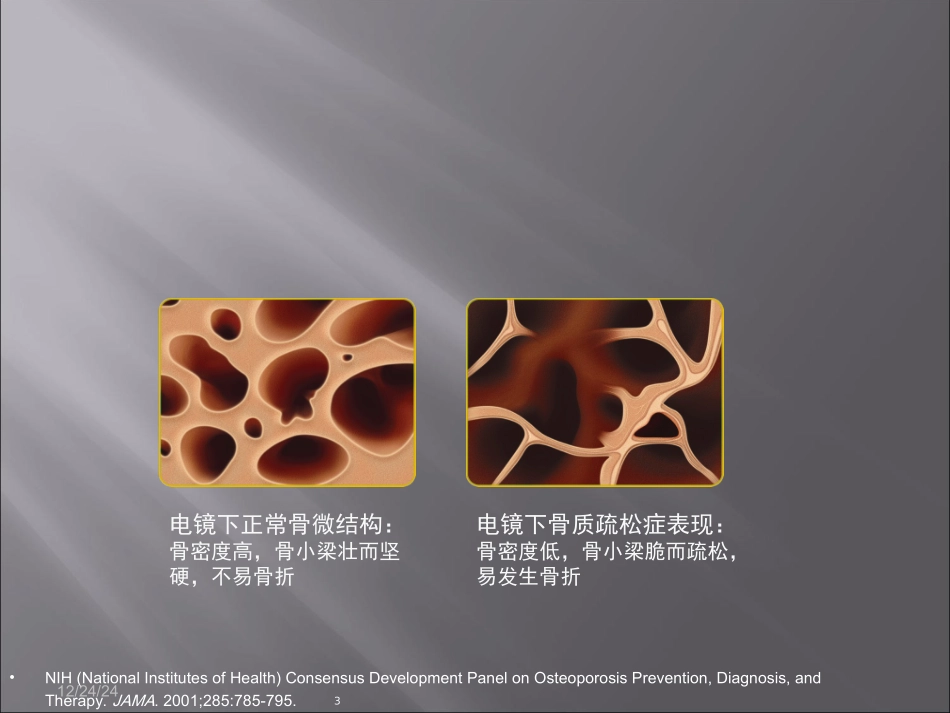 COPD合并骨质疏松症_第3页