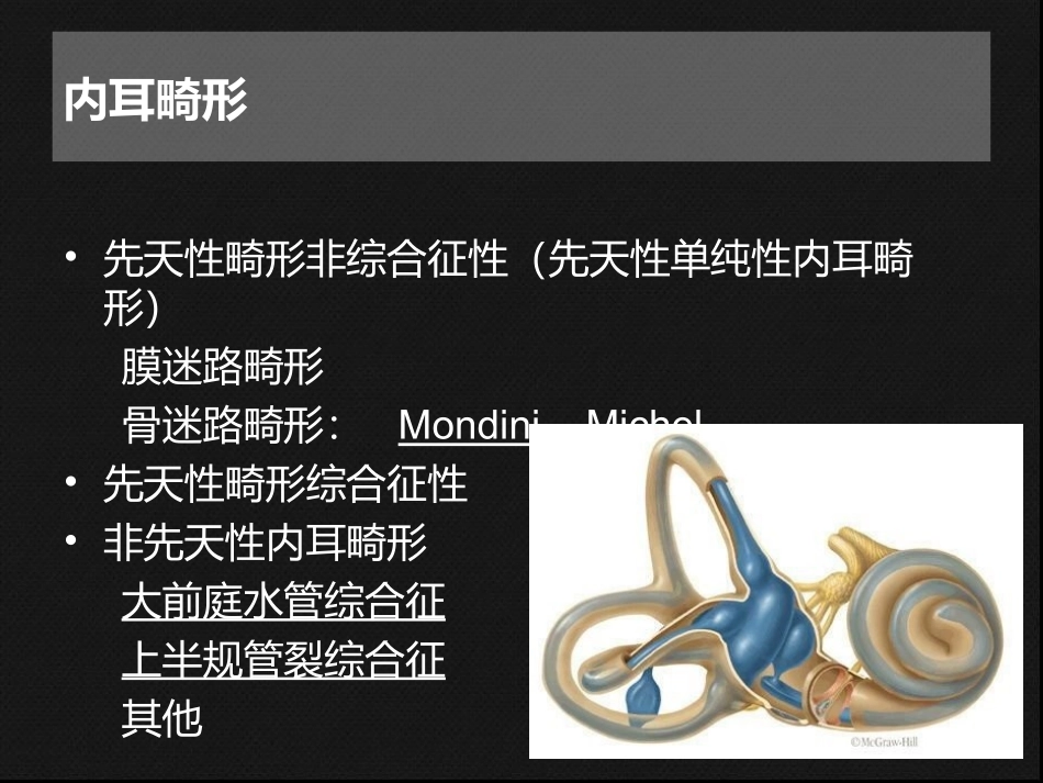内耳畸形CT表现_第2页