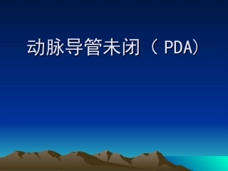 动脉导管未闭(PDA
