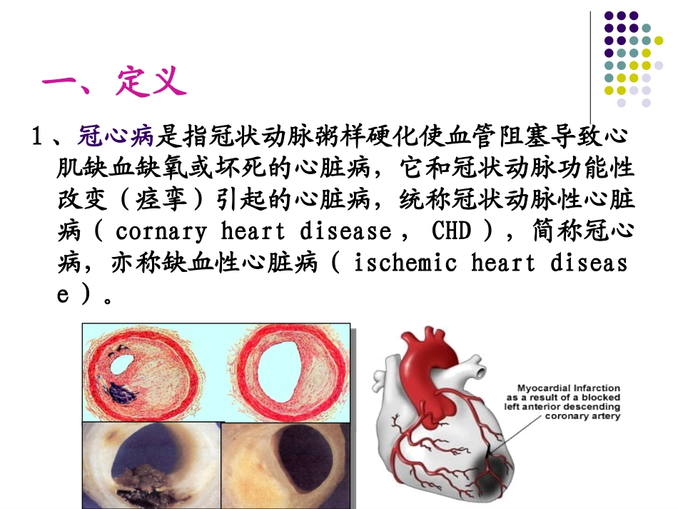 冠状动脉粥样硬化性_第2页