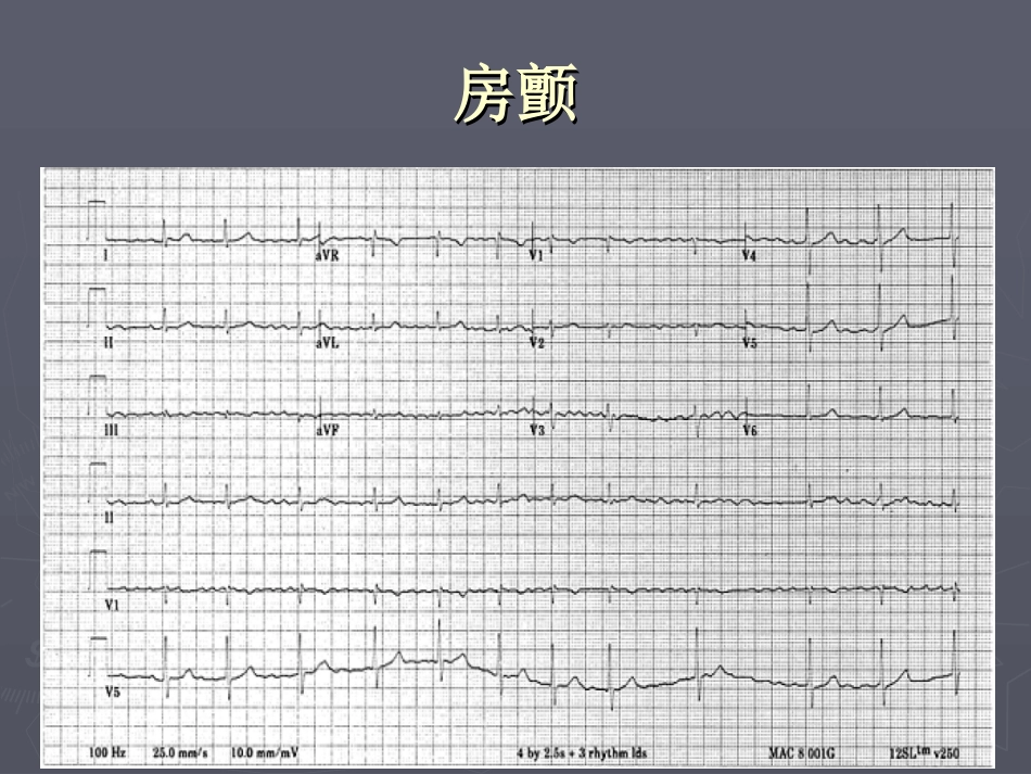 房颤的药物治疗_第2页