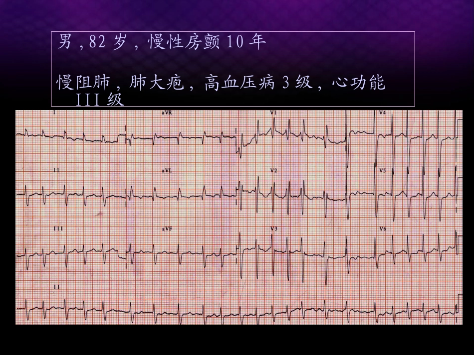 房颤导管消融的适应症_第3页