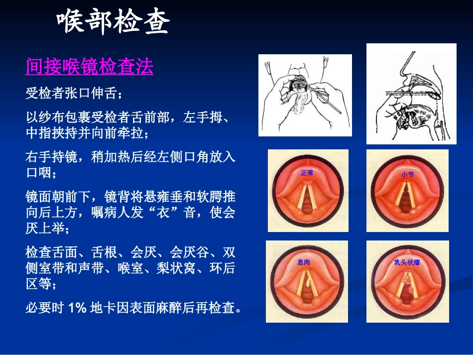 间接喉镜检查_第2页