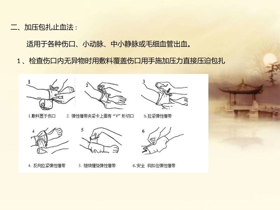 止血包扎ppt._第3页