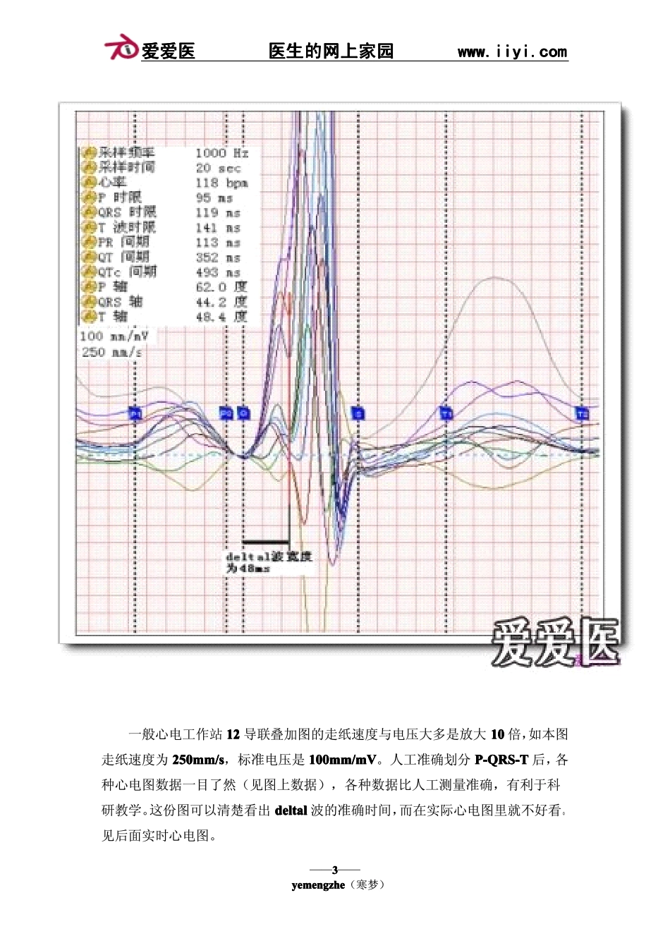 (十三)正常心电图、心律失常_第3页