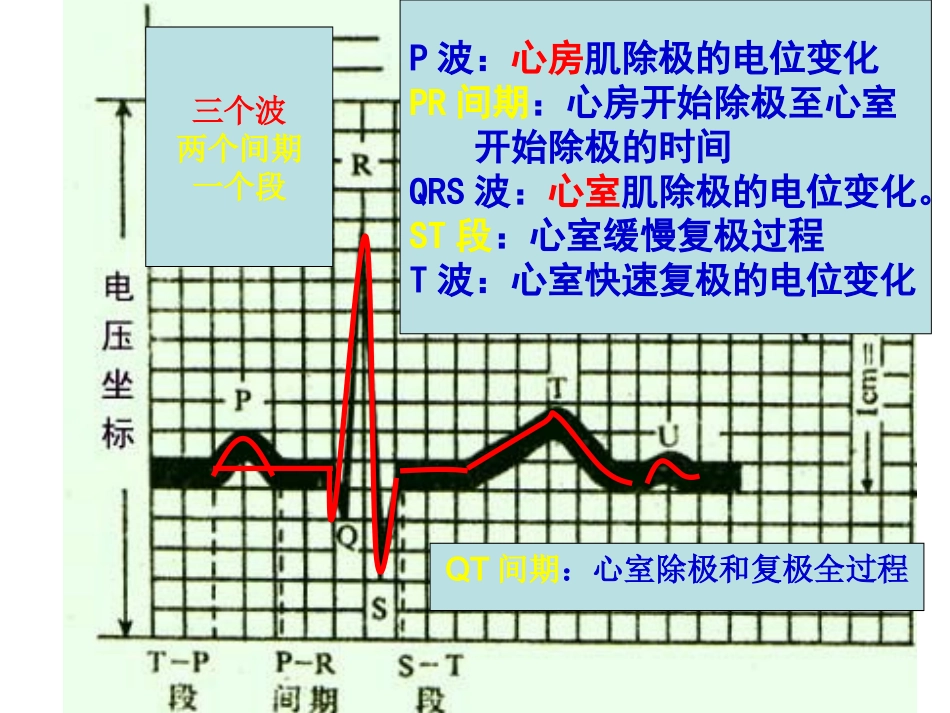 第三讲异常心电图_第3页