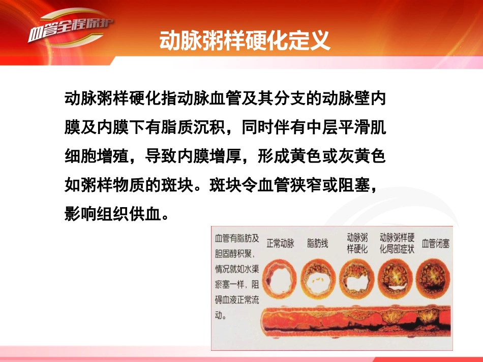 动脉粥样硬化-2015_第3页
