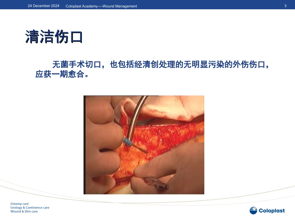 感染伤口的处理_第3页