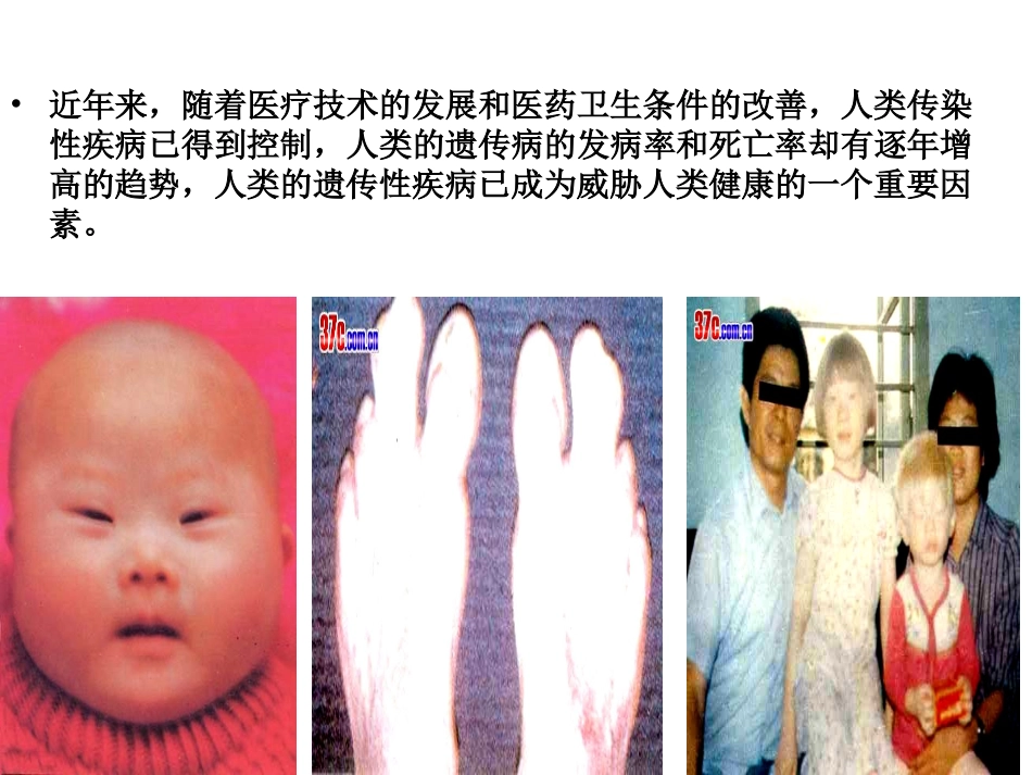 人类遗传病与优生_第3页