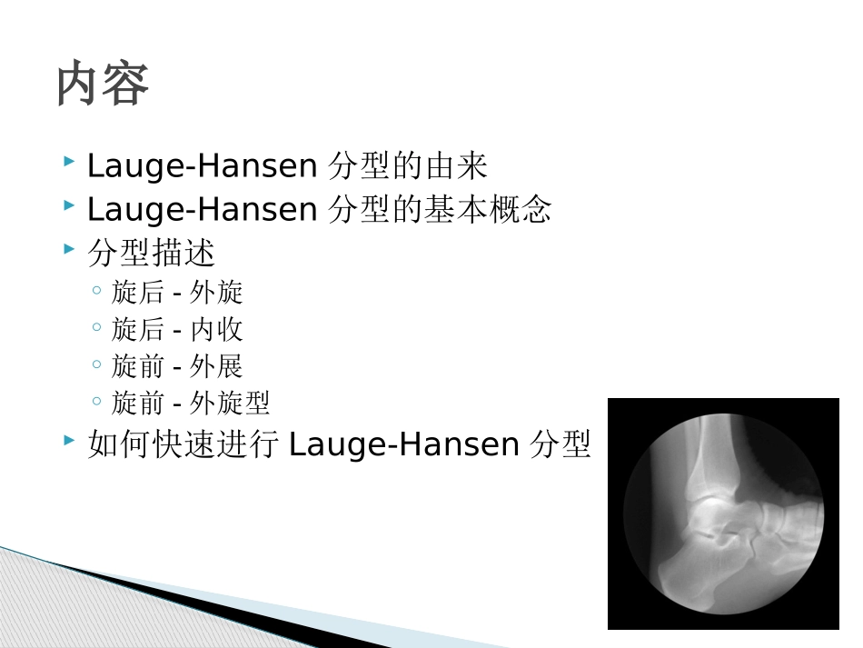 如何正确认识踝关节骨折的Lauge-Hansen分型_第2页