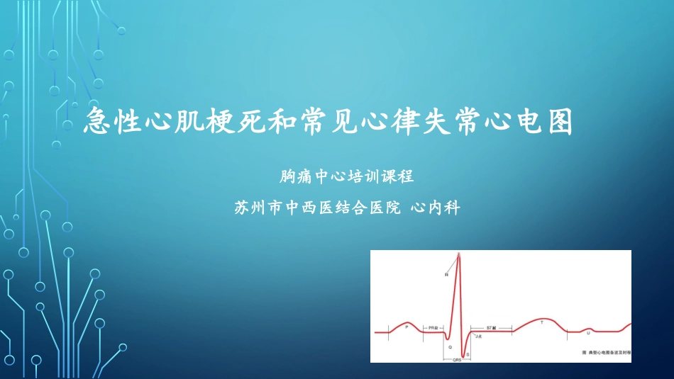 急性心肌梗死和常见心律失常心电图_第1页