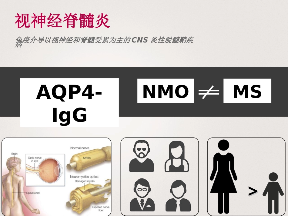 中国NMOSD诊治指南2015_第2页