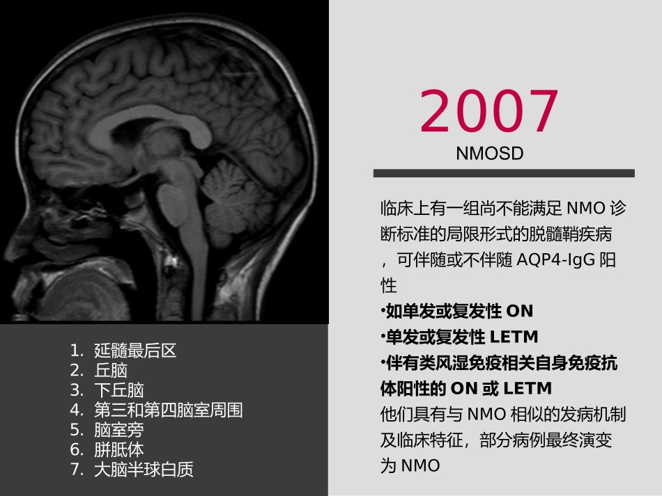 中国NMOSD诊治指南2015_第3页