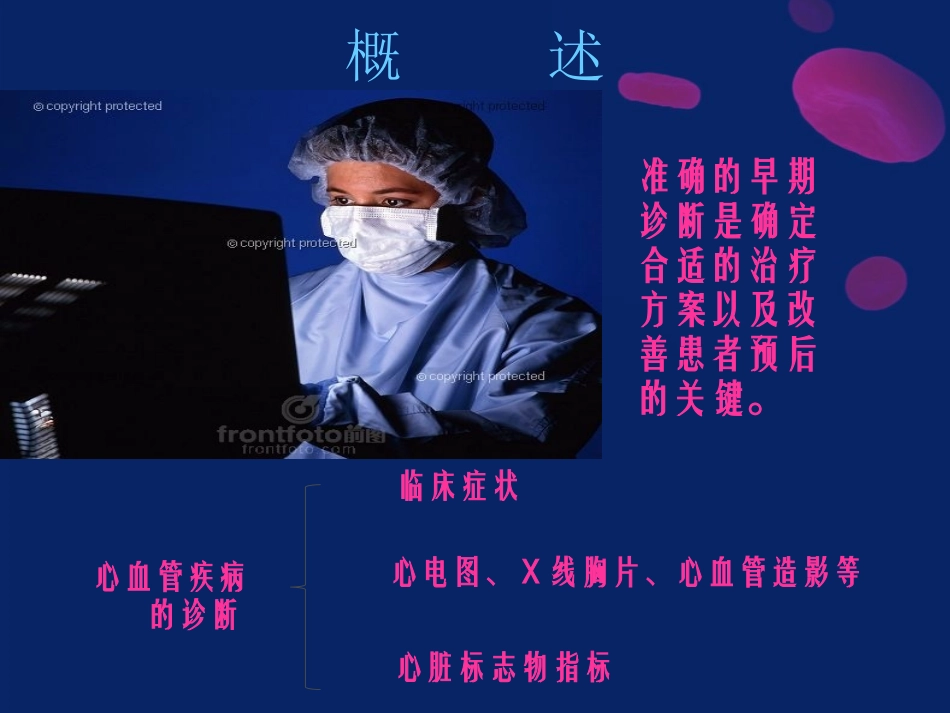 心脏标志物.新讲解.徐_第3页