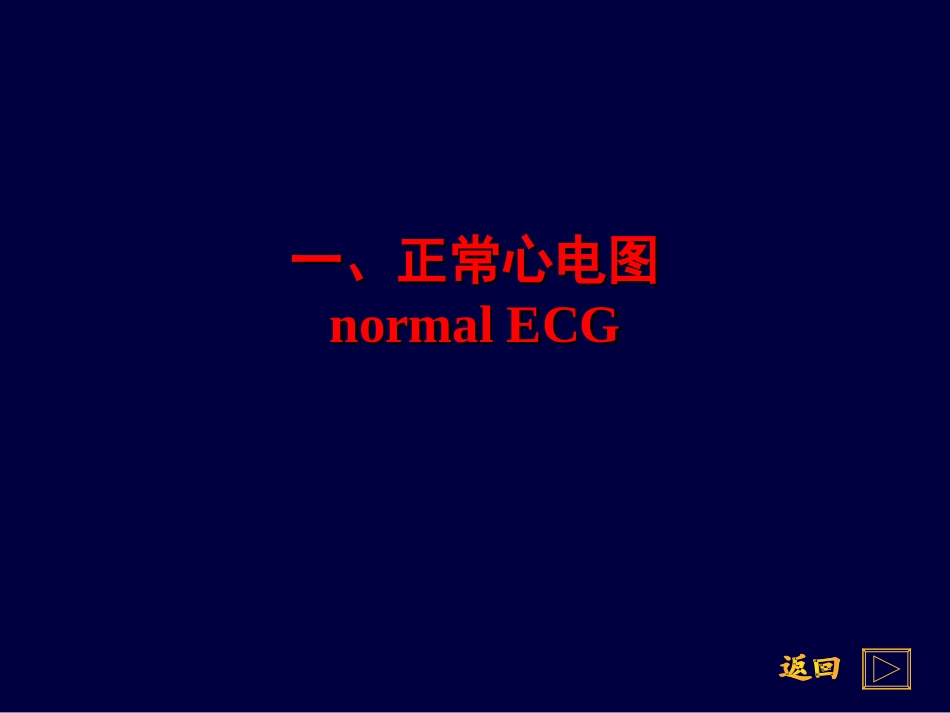 常见心电图识别.ppt_第2页