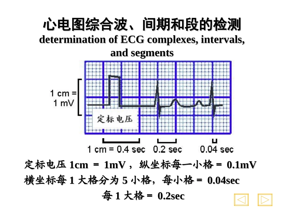 常见心电图识别.ppt_第3页