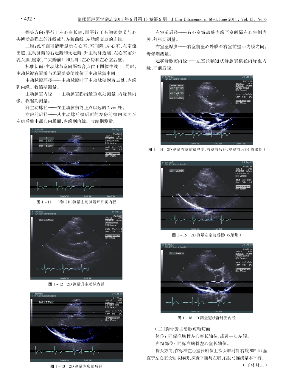 《超声心动图规范检测心脏功能与正常值》(连载一)_第3页