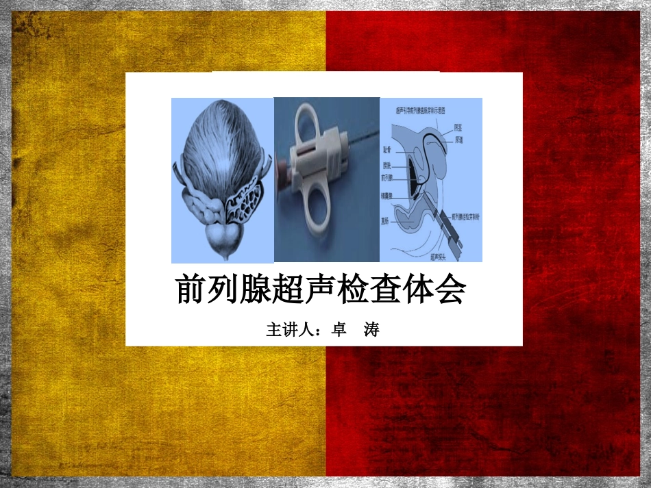 前列腺超声检查体会汇总_第1页