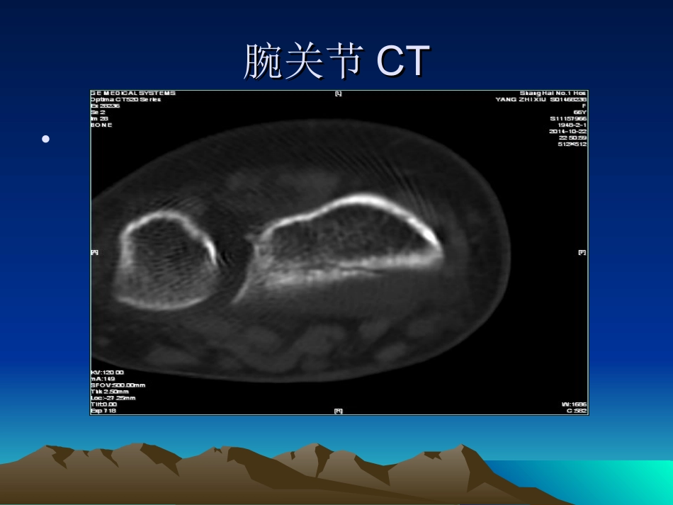 容易遗漏骨折.整理_第3页