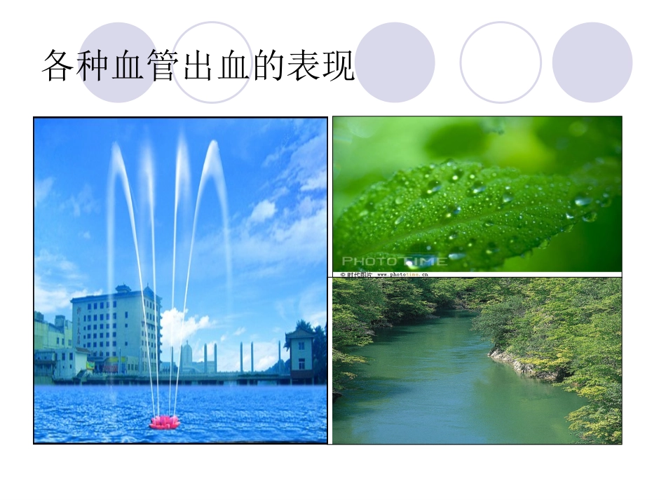 户外止血与包扎步骤_第3页