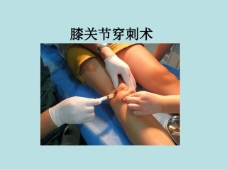 膝关节穿刺术