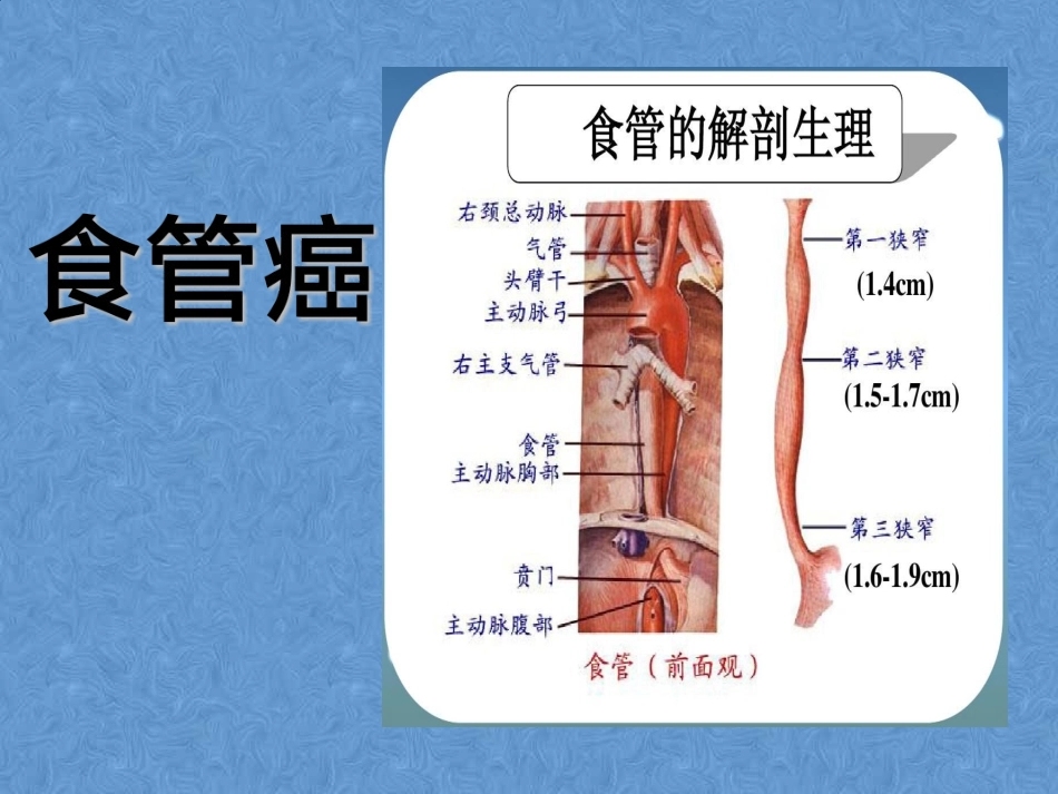 F4食管癌病例讨论_第2页