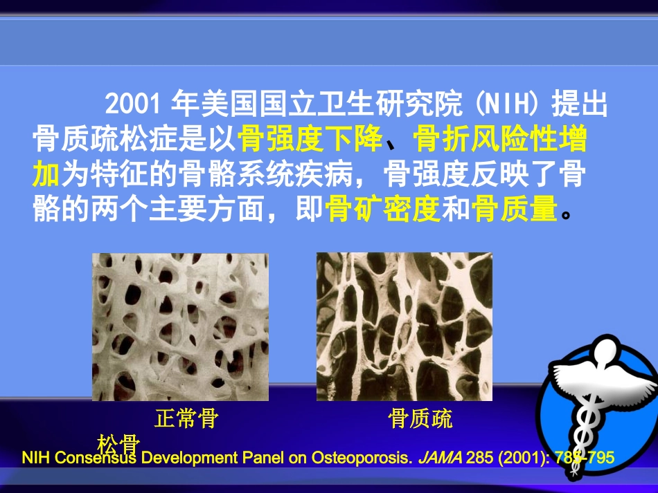 糖皮质激素所致骨质疏松症_第2页