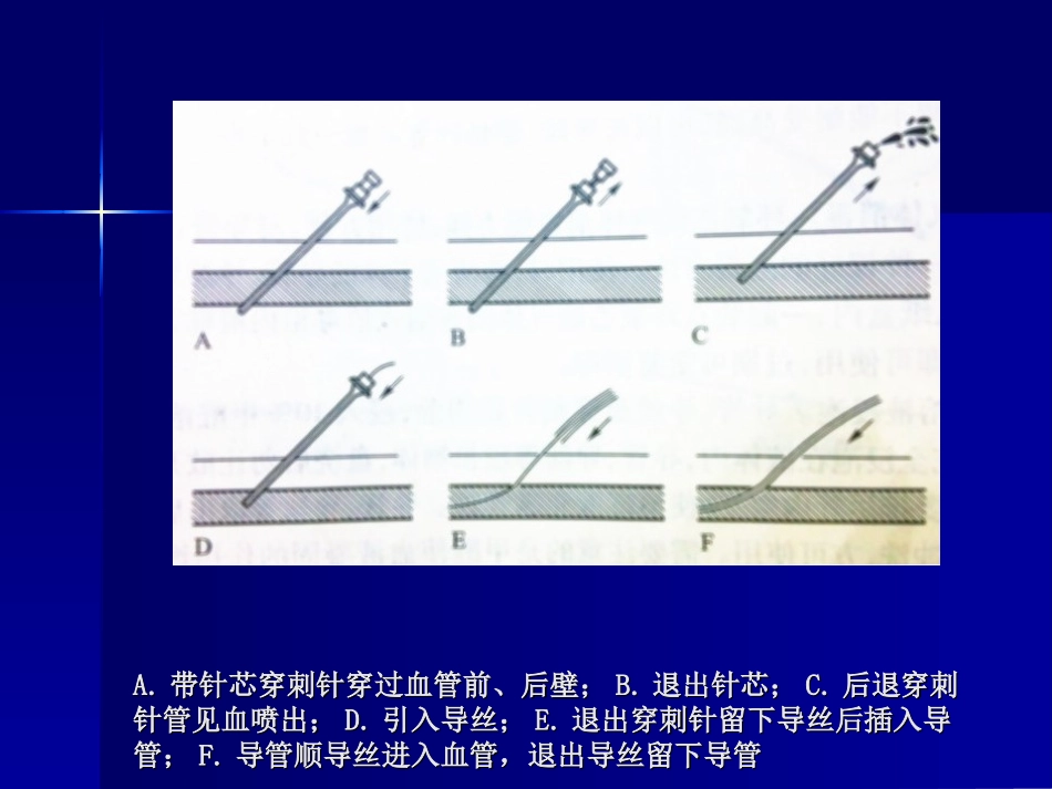 支架血管成形术器材-雅安职业技术学院_第3页