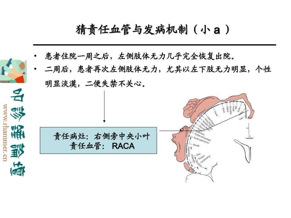 从影像学梗死部位推测责任供血血管_第3页