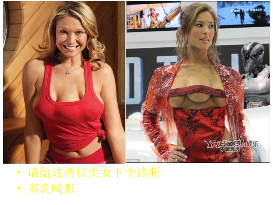 第二讲正常心电图_第3页