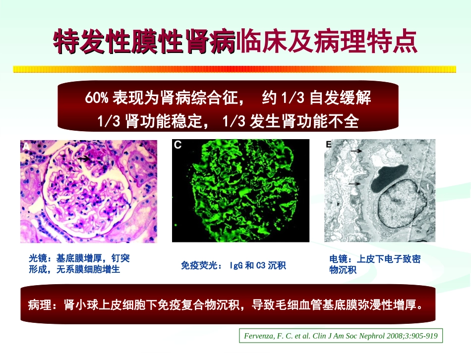 陈江华-膜性肾病治疗策略_第2页