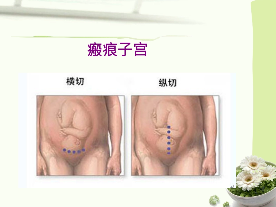 产后出血指南2014-镇海2015_第2页