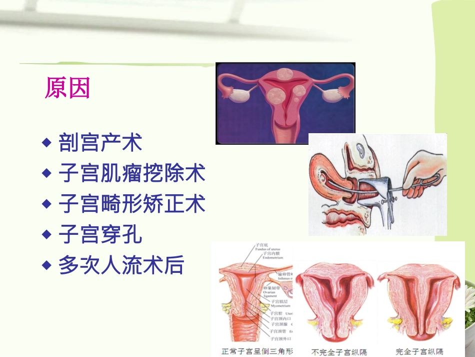 产后出血指南2014-镇海2015_第3页