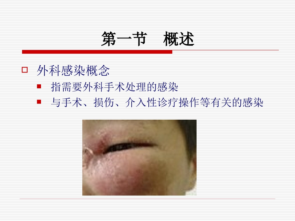 第七章_外科感染病人的护理.ppt1_第3页