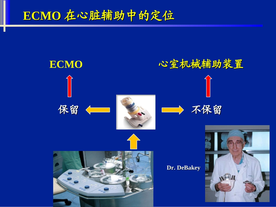 ECMO在心脏辅助中的应用_第2页