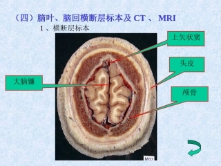 头颈部—fy